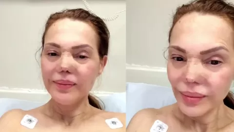 Carmen Campuzano Reaparece Irreconocible: Nueva Cirugía Nasal Desata Ola de Reacciones y Debate en Redes